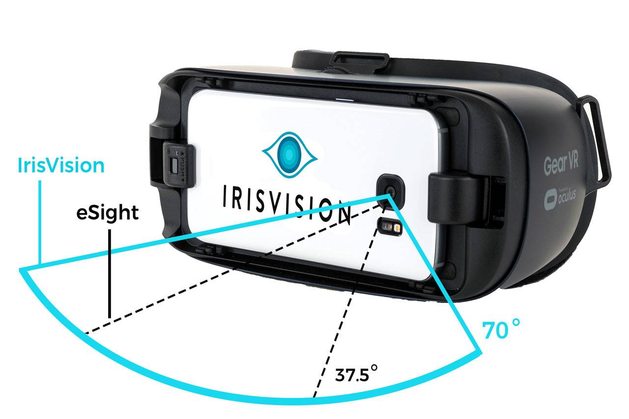 IrisVision UT for eyes