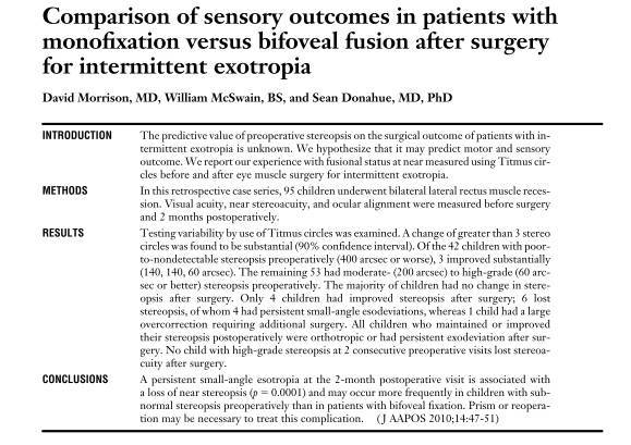 Interrmittent Exotropia